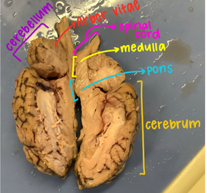 Labeled brain dissection in science class